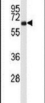 Cortactin Antibody in Western Blot (WB)