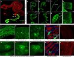 Phospho-SRC (Tyr419) Antibody in Immunohistochemistry (IHC)