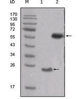 SRC Monoclonal Antibody (5D10C4)