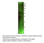 SRD5A3 Polyclonal Antibody