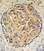 SRD5A3 Antibody in Immunohistochemistry (IHC)