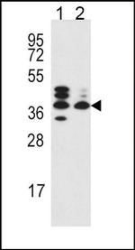 SRD5A3 Antibody in Western Blot (WB)