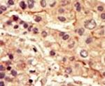 SRMS Antibody in Immunohistochemistry (IHC)