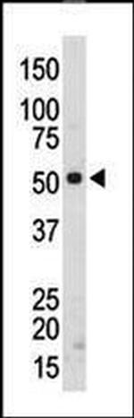 SRMS Antibody in Western Blot (WB)