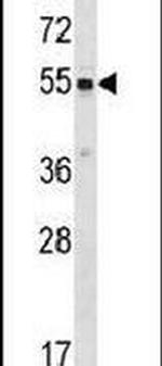 SRMS Antibody in Western Blot (WB)