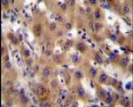 SRPK1 Antibody in Immunohistochemistry (IHC)