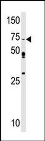 SRPK1 Antibody in Western Blot (WB)