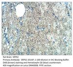 SRPX2 Polyclonal Antibody