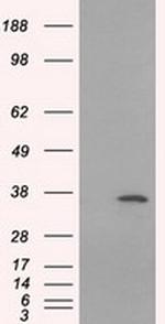 SRR Antibody in Western Blot (WB)