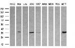 SRR Antibody in Western Blot (WB)