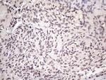 SRSF9 Antibody in Immunohistochemistry (Paraffin) (IHC (P))