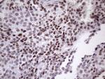 SRSF9 Antibody in Immunohistochemistry (Paraffin) (IHC (P))