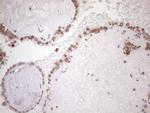 SRSF9 Antibody in Immunohistochemistry (Paraffin) (IHC (P))
