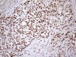 SRSF9 Antibody in Immunohistochemistry (Paraffin) (IHC (P))