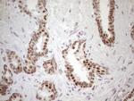 SRSF9 Antibody in Immunohistochemistry (Paraffin) (IHC (P))