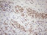 SRSF9 Antibody in Immunohistochemistry (Paraffin) (IHC (P))