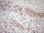 SRSF9 Antibody in Immunohistochemistry (Paraffin) (IHC (P))