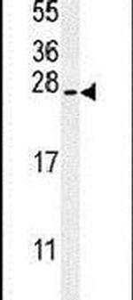 SERTAD3 Antibody in Western Blot (WB)