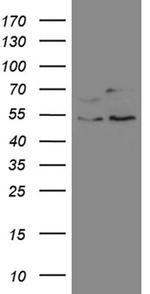 SS18 Antibody in Western Blot (WB)