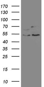 SS18 Antibody in Western Blot (WB)