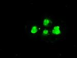 SSB Antibody in Immunocytochemistry (ICC/IF)