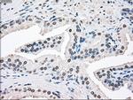 SSB Antibody in Immunohistochemistry (Paraffin) (IHC (P))