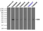 SSB Antibody in Immunoprecipitation (IP)