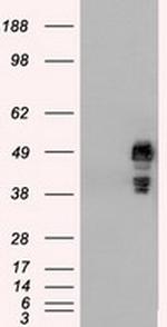SSB Antibody in Western Blot (WB)
