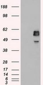 SSB Antibody in Western Blot (WB)
