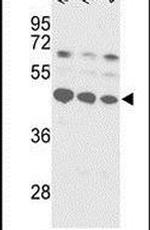 SSB Antibody in Western Blot (WB)