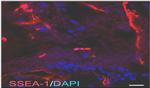 SSEA1 Antibody in Immunohistochemistry (Paraffin) (IHC (P))