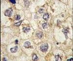TRAP alpha Antibody in Immunohistochemistry (IHC)