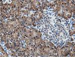 SSR1 Antibody in Immunohistochemistry (Paraffin) (IHC (P))