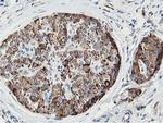 SSR1 Antibody in Immunohistochemistry (Paraffin) (IHC (P))