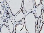 SSR1 Antibody in Immunohistochemistry (Paraffin) (IHC (P))
