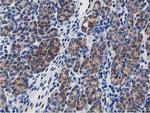 SSR1 Antibody in Immunohistochemistry (Paraffin) (IHC (P))