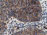 SSR1 Antibody in Immunohistochemistry (Paraffin) (IHC (P))