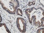 SSR1 Antibody in Immunohistochemistry (Paraffin) (IHC (P))