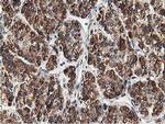 SSR1 Antibody in Immunohistochemistry (Paraffin) (IHC (P))
