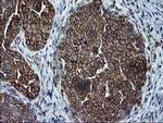 SSR1 Antibody in Immunohistochemistry (Paraffin) (IHC (P))
