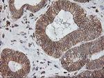 SSR1 Antibody in Immunohistochemistry (Paraffin) (IHC (P))