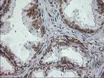 SSR1 Antibody in Immunohistochemistry (Paraffin) (IHC (P))