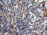 SSR1 Antibody in Immunohistochemistry (Paraffin) (IHC (P))