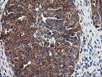 SSR1 Antibody in Immunohistochemistry (Paraffin) (IHC (P))