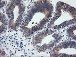 SSR1 Antibody in Immunohistochemistry (Paraffin) (IHC (P))