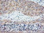 SSR1 Antibody in Immunohistochemistry (Paraffin) (IHC (P))