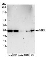 SSR1/TRAP alpha Antibody in Western Blot (WB)