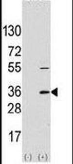 TRAP alpha Antibody in Western Blot (WB)