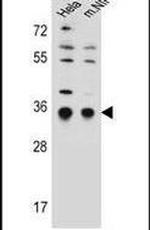 TRAP alpha Antibody in Western Blot (WB)