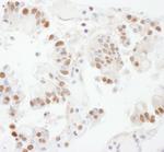 SSRP1 Antibody in Immunohistochemistry (IHC)
